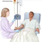 Paciente que recibe quimioterapia intravenosa
