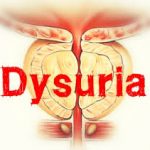 Dysuria (Painful urination)