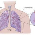 Small Cell Lung Cancer | Ankr - Cancer Education & Navigation Platform