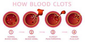 Low platelets (thrombocytopenia)