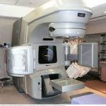 Stereotactic body radiation therapy