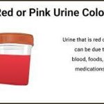 Red urine