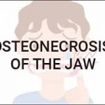 Osteonecrosis of jaw