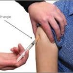 Subcutaneous injection